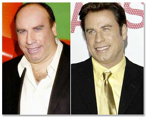 John Travolta Careca